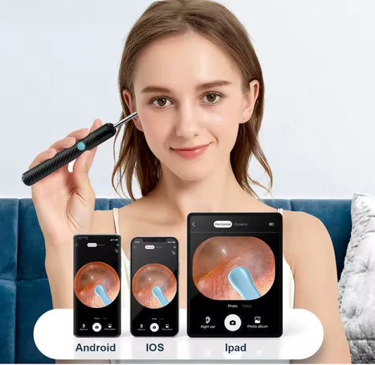 👂 Aurix Pro™ – Limpieza de Oídos con Cámara HD 🌟